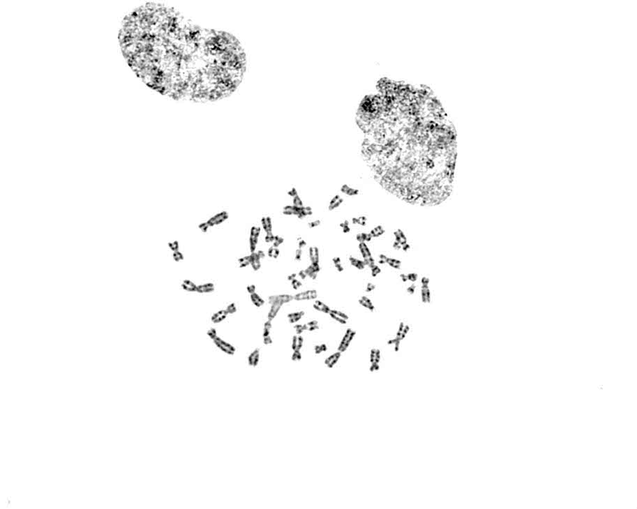 G5