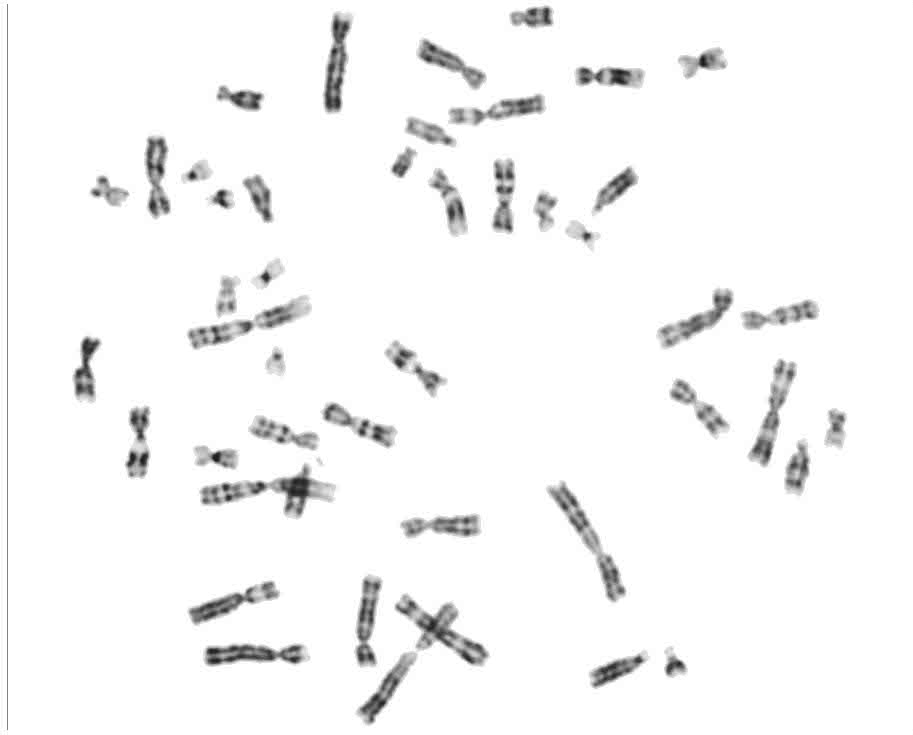 G2t